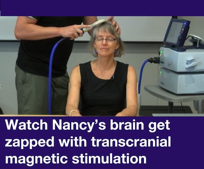 Watch Nancy Kanwisher's brain get zapped with TMS