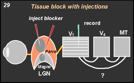 tissue block with injections