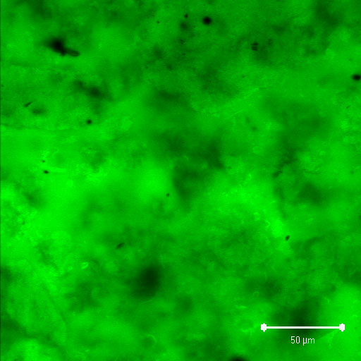 Laser scanning confocal microscopy image of a protein gel.
