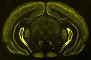 yellow coronal