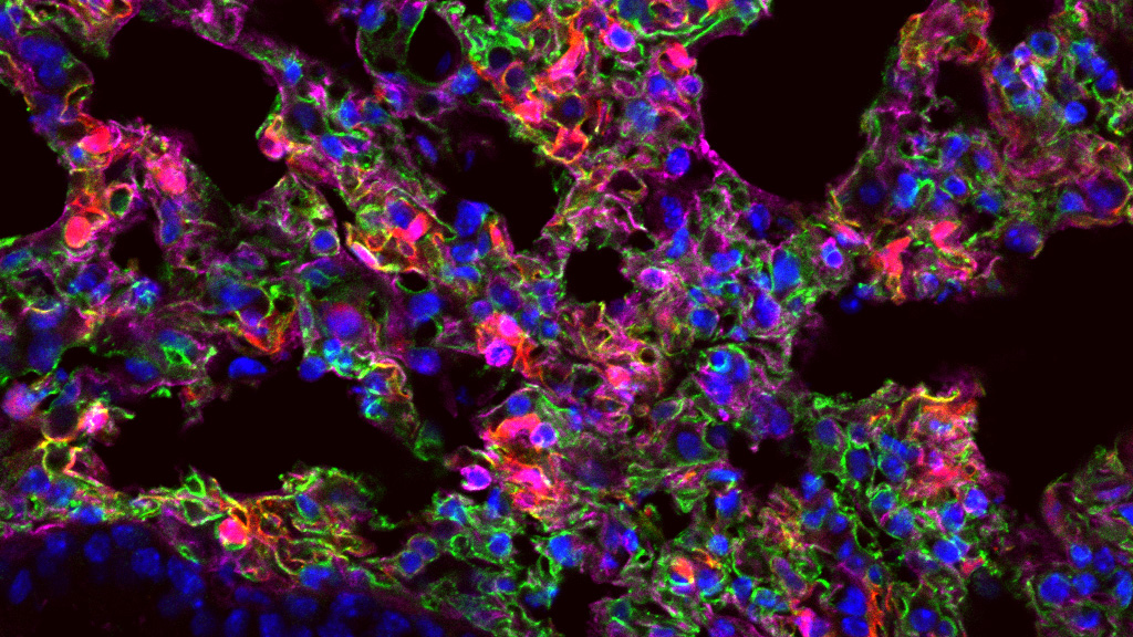 image by Piotr Kowalski showing lung cells expressing synthetic mRNA (shown in red)