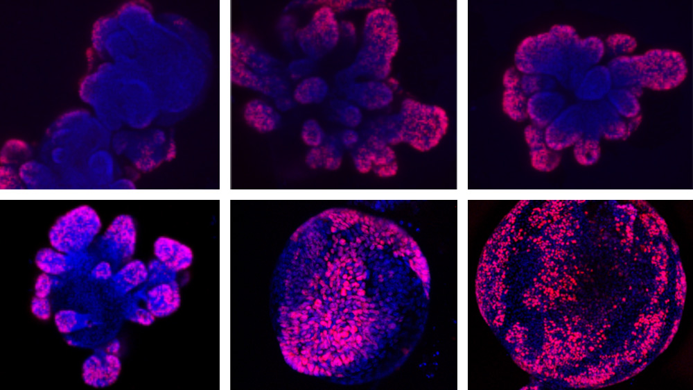 Images showing cell crowding
