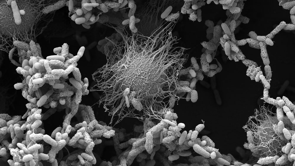 Gray scanning electron microscope image shows a microbial community with empty space, including some that are fuzzy and pill-shaped and some larger that look like balls exuding tendrils.