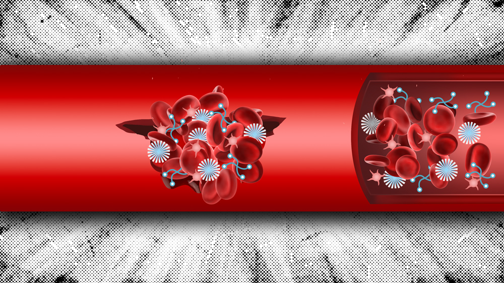 A tubular red vein is on a decorative background. Inside, 2 clumps of red blood cells are clotting, thanks to two types of nanoparticles, depicted as light blue and white icons.