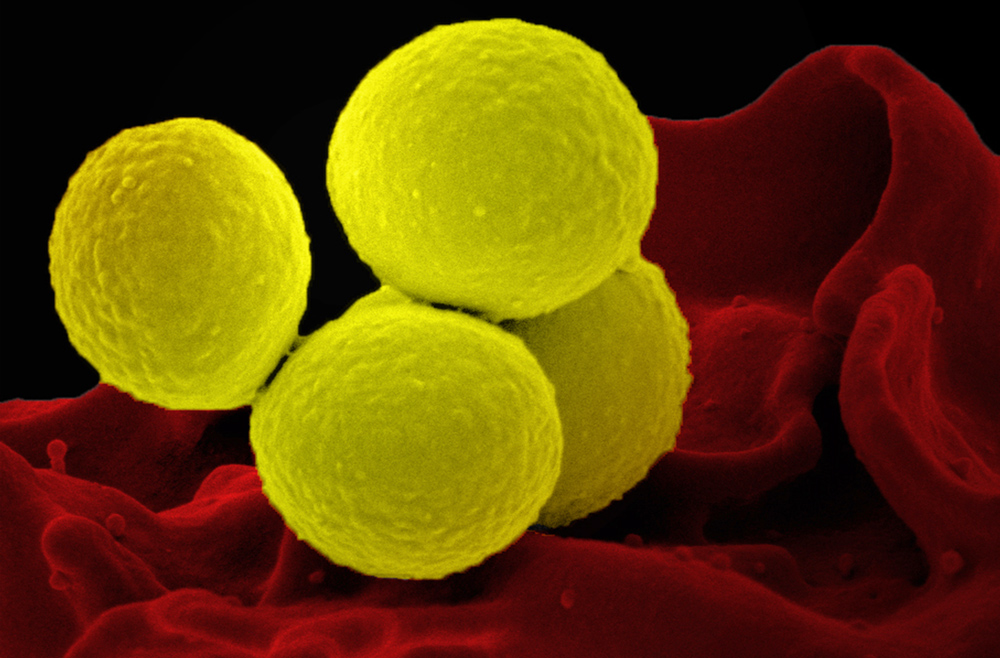 Closeup of 4 yellow spherical bacteria with bumpy surfaces. Background is red, organic shape.