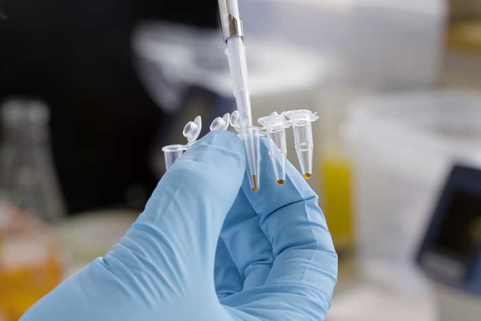 A blue-gloved hand holds a plastic tray, while a pipette adds brown liquid to each container.