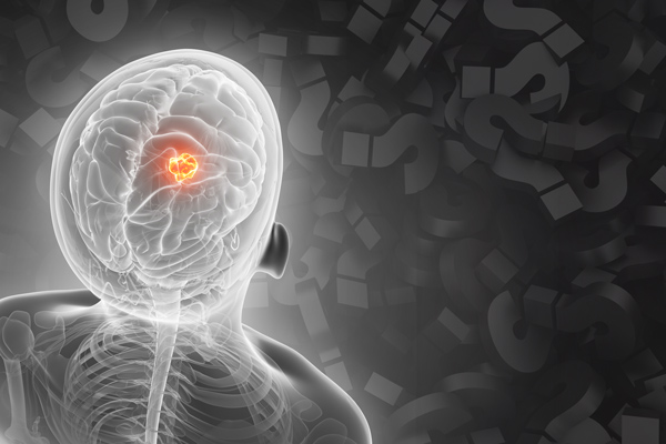 a human figure with a brain tumor looking at a field of question marks