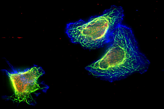 Biomarker may help guide cancer therapy, avoid drug resistance