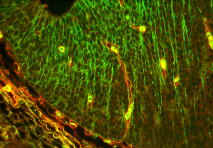 angiogenesis and glial cells