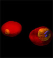 3D images of a human red blood cell (RBC) invaded by malaria-inducing parasite Plasmodium falciparum, at different stages of parasite development.