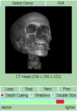 CT Head