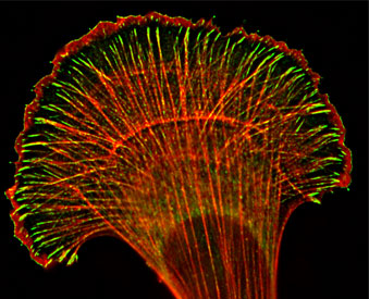 Immunofluorescent images highlighting the role of VASP (green) and actin (red) in cell motility.