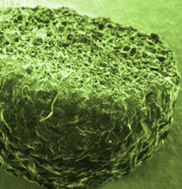 Electron microscopic image of a biocompatible particle used in new  drug delivery systems.