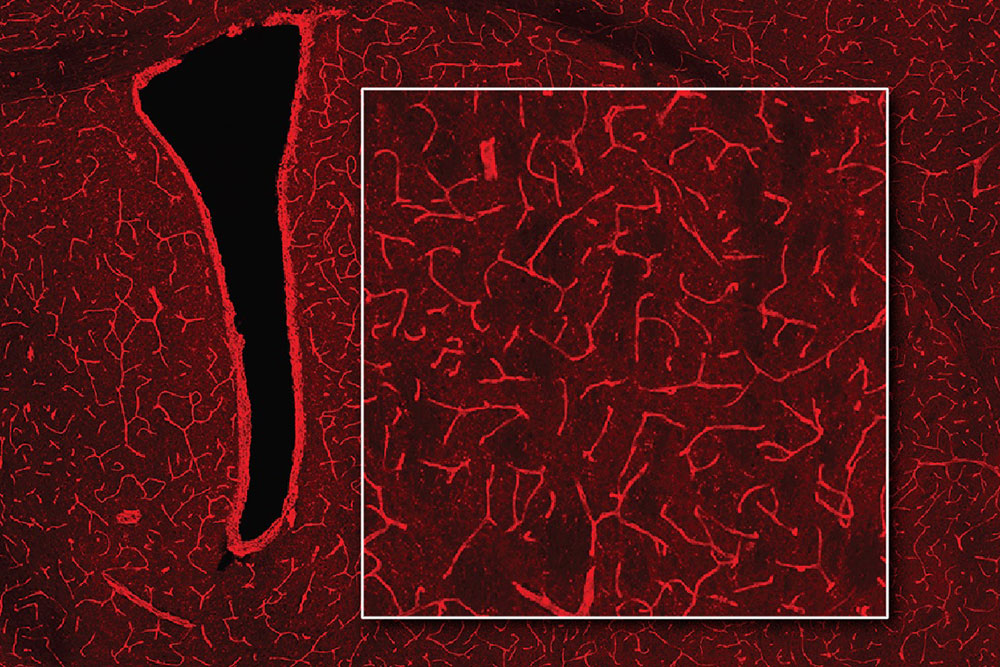 A MRI image of a brain shows bright red blood vessels on a darker red background