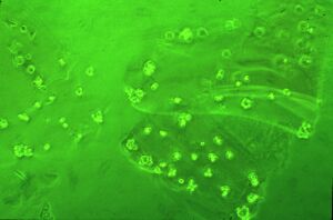 Cell_on_peptide_matrix.jpg (9624 bytes)