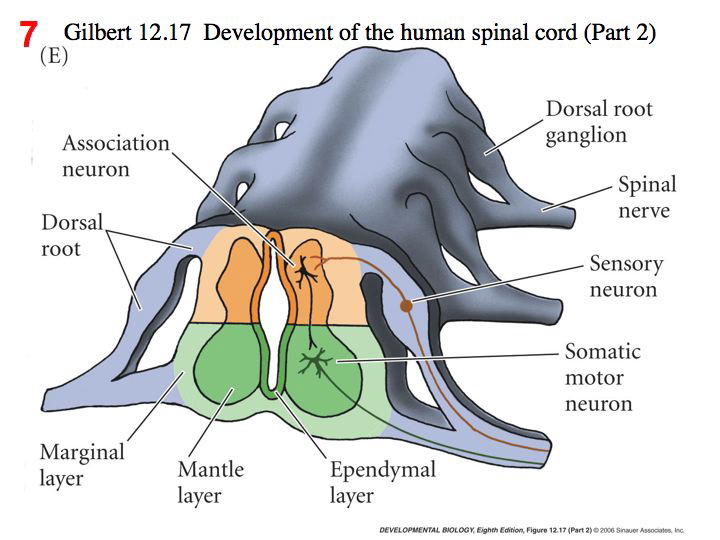 slide11.jpg