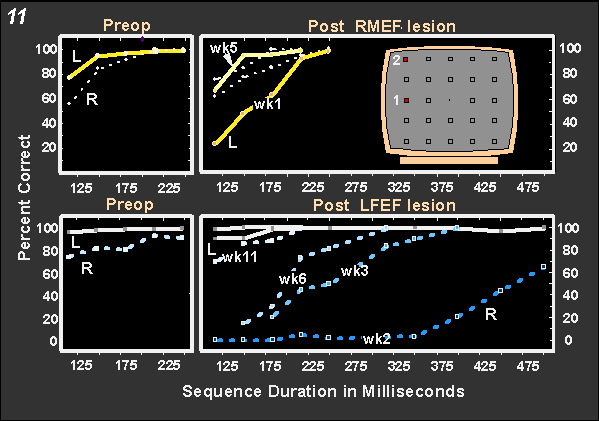 Sequential target task performance after FEF and MEF lesions