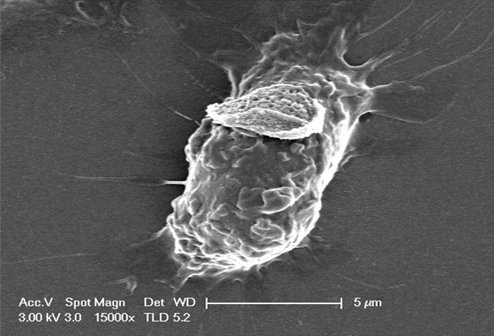 Scanning electron micrograph showing the interaction of backpacks with macrophages after 3 h of incubation in standard cell culture conditions
