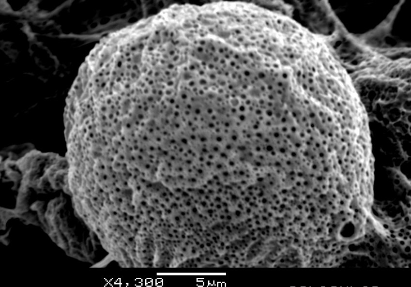Corpuscular PMMA microbead