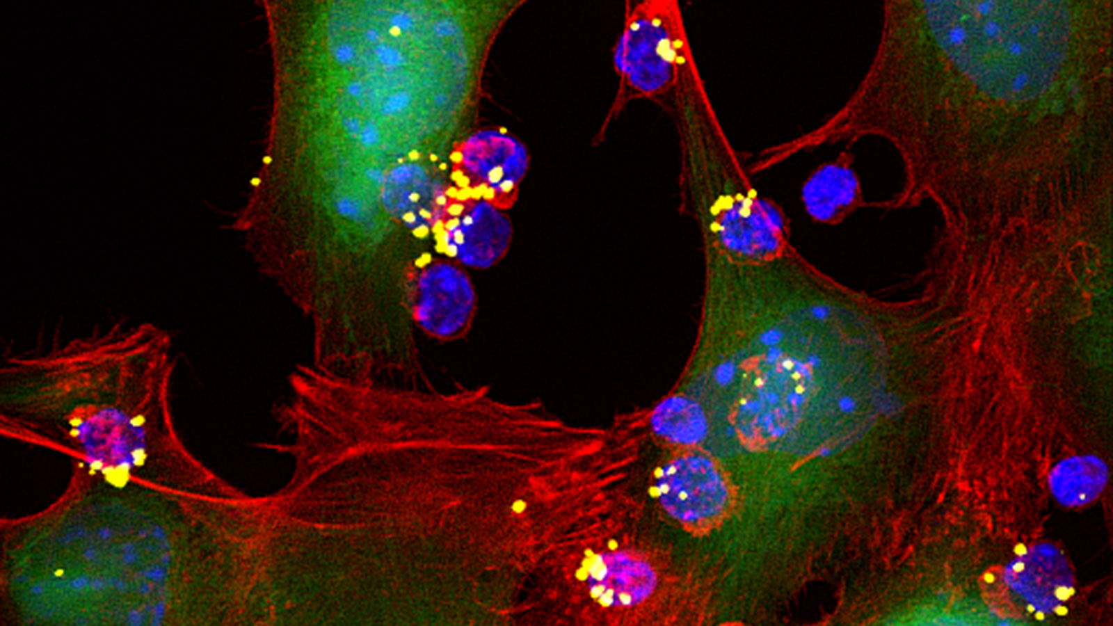 an image of t-cells by Sudha Kumari and Yiran Zhen