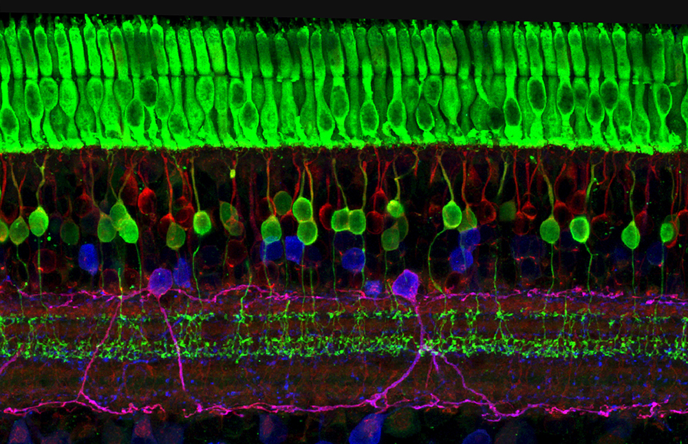 A colorful image of the many layers of nerve cells in the retina