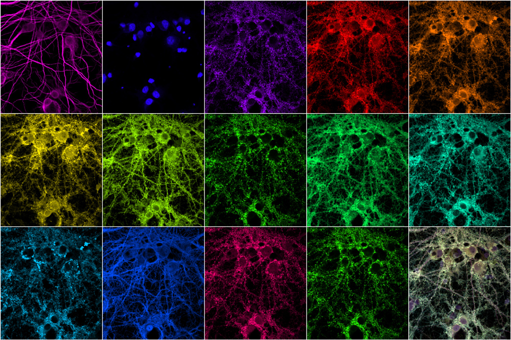 a multi-colored checkerboard of synapse images