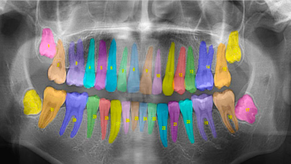 a colorized and coded x-ray of human teeth