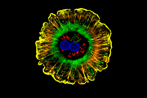 a colorized human liver cell