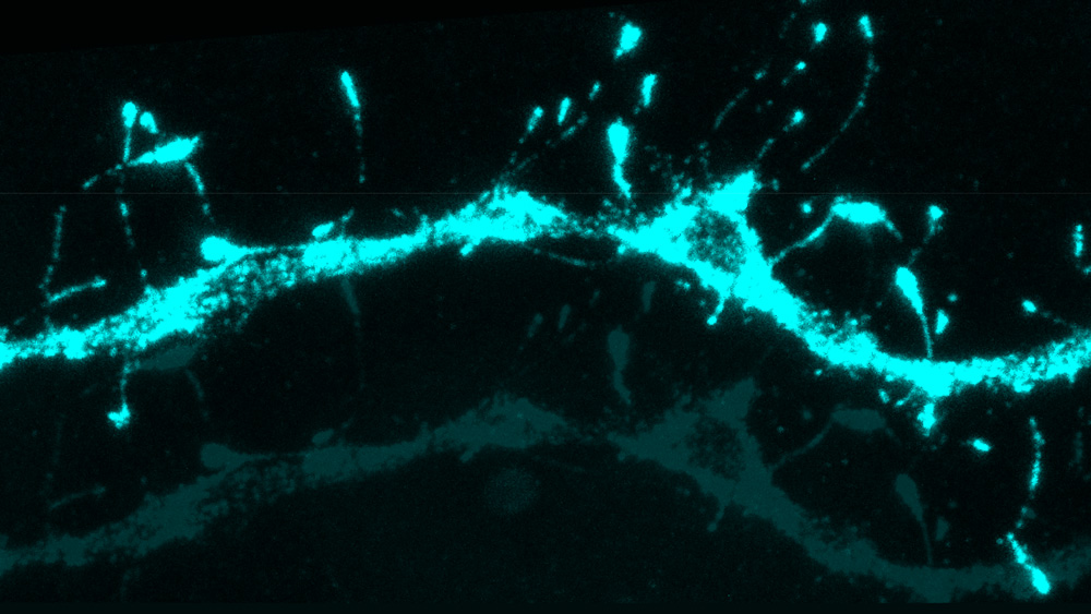 A thick thread-like synapse goes across the image, with thin threads emerging on top, in light blue.