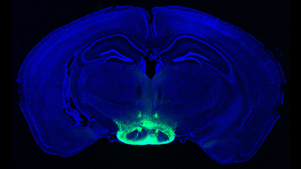 spotlight-vulnerable-neurons-mit-massachusetts-institute-of-technology