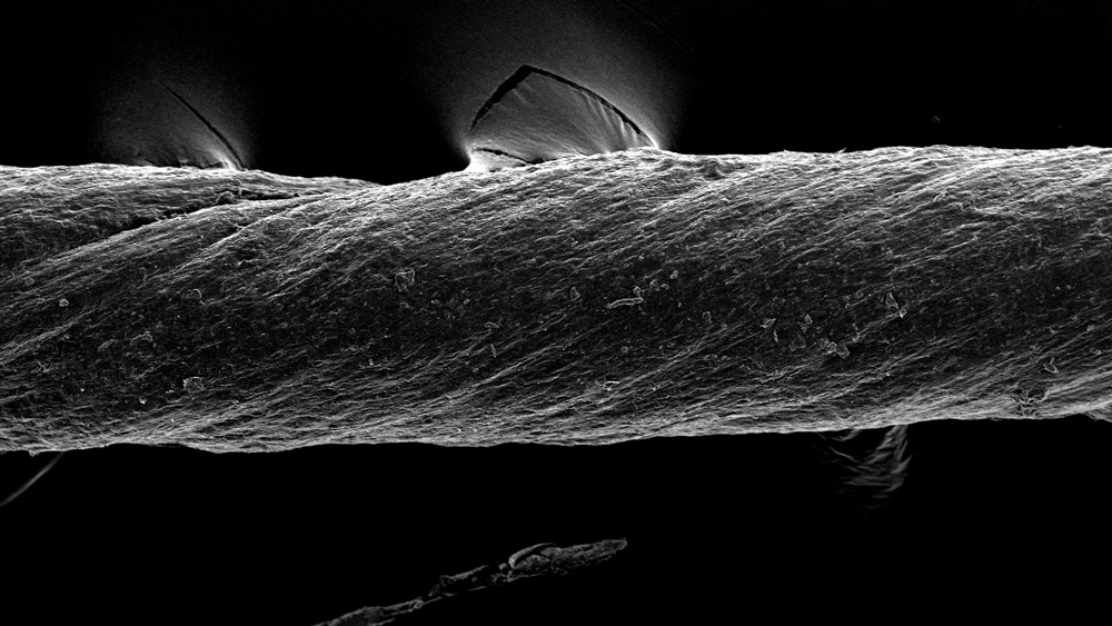 A SEM image shows an extreme closeup of the suture, which has a rope-like texture.