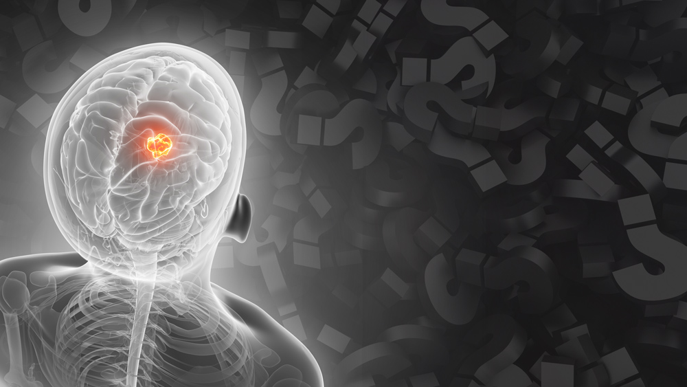 a human figure with a brain tumor looking at a field of question marks