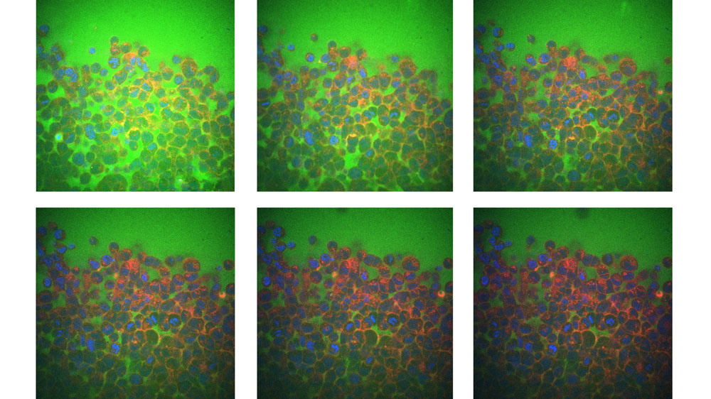 6 boxes show colorful cells in different densities