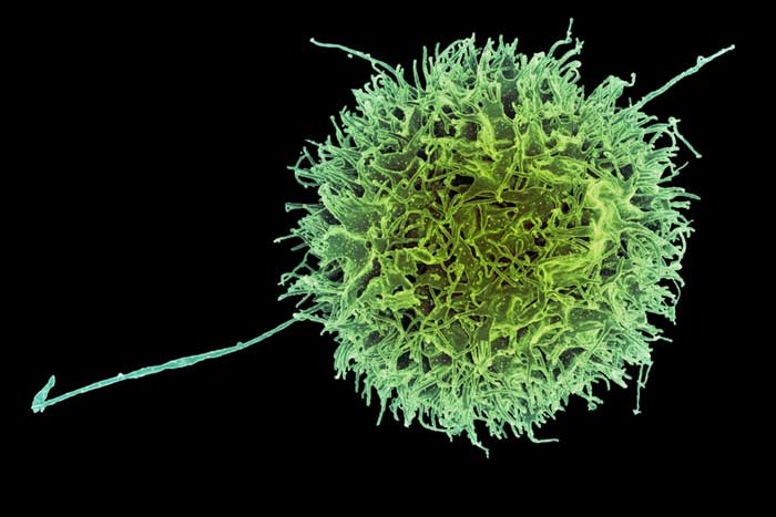 cancer cell