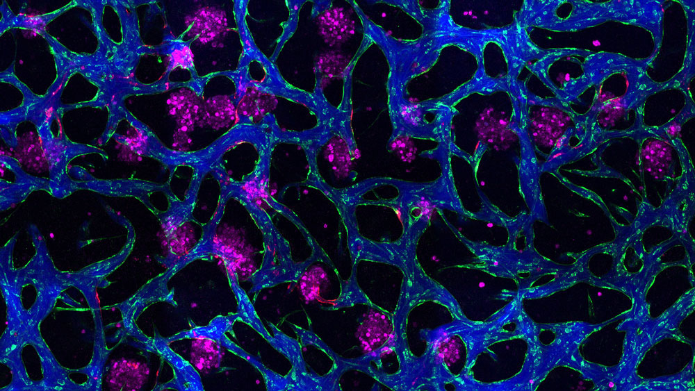 colorized microscopy of blood vessels with dye flowing through
