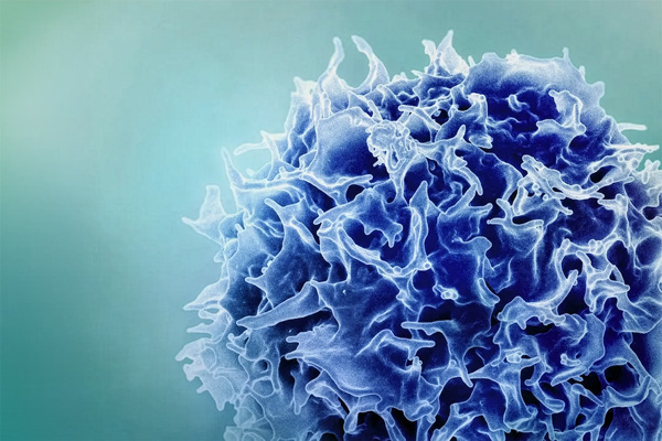 hairy T-cell