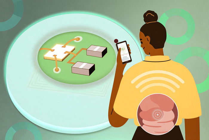 A person looks at the phone to monitor a tiny device in their GI tract