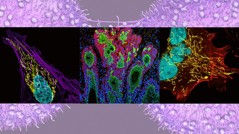 different types of cancer cells