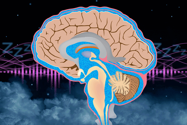 brain with animated 'noise'